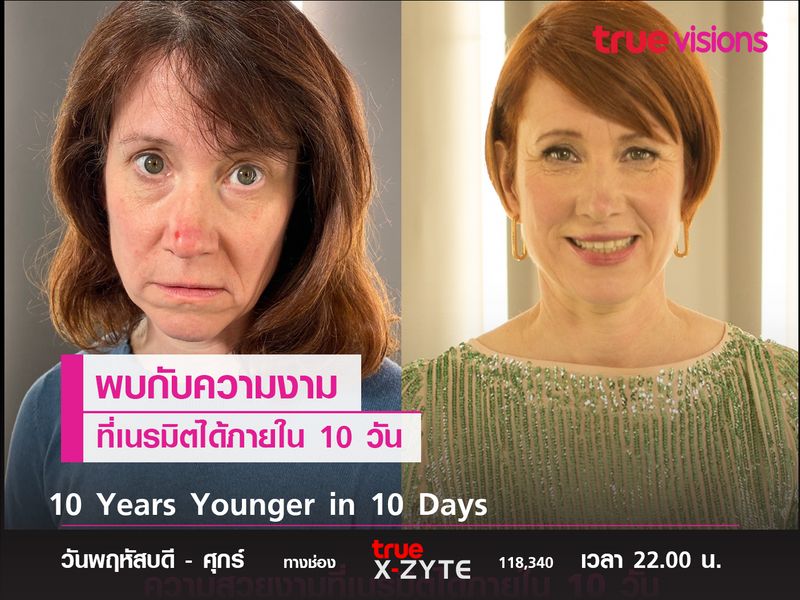 พบกับความงามที่เนรมิตได้ภายใน 10 วัน